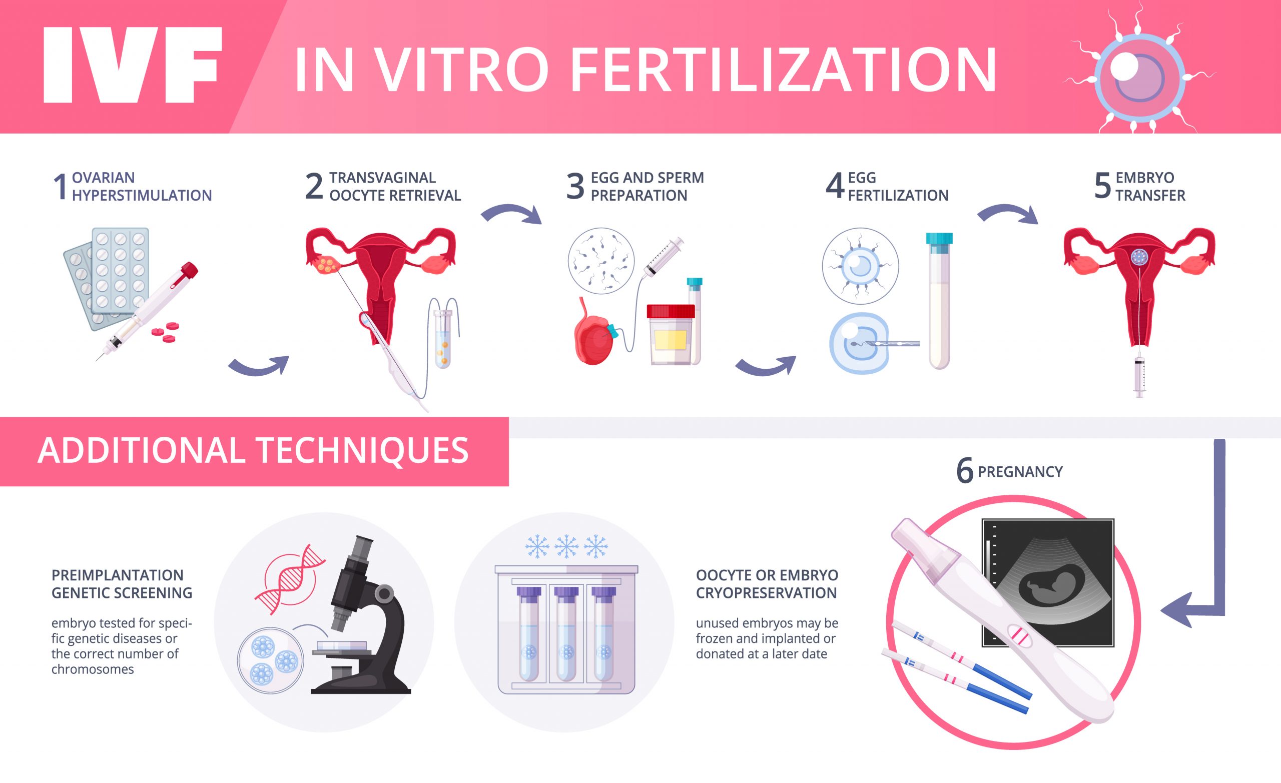 In Vitro Fertilization IVF Flat Infographics