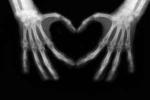 X-ray